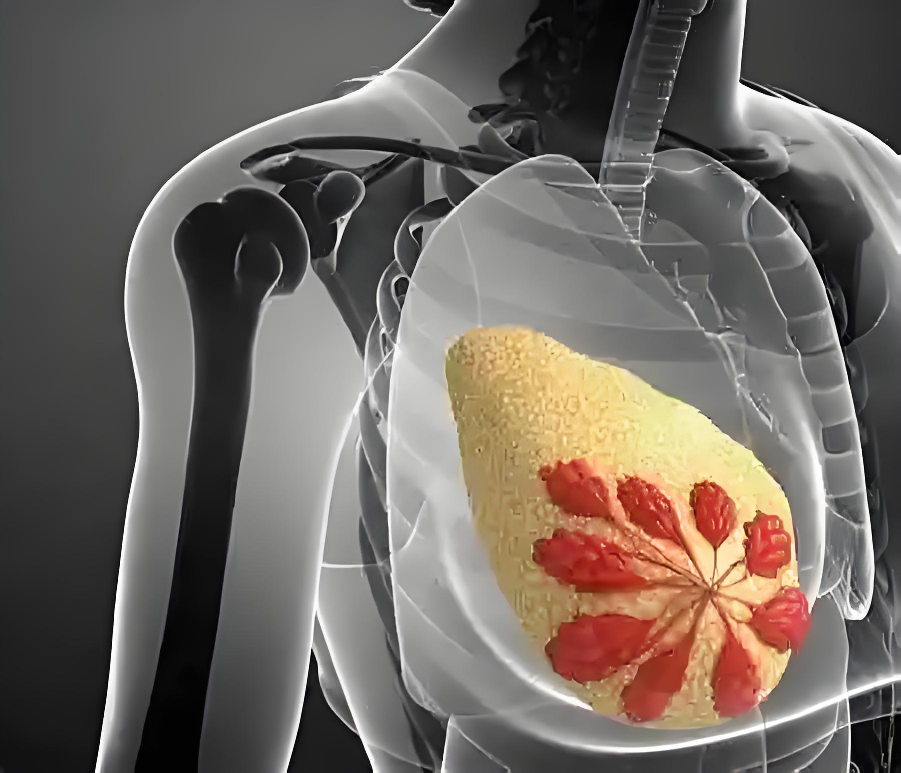 微环境调控新视角：哈医大研究揭示乳腺癌精准治疗潜在路径