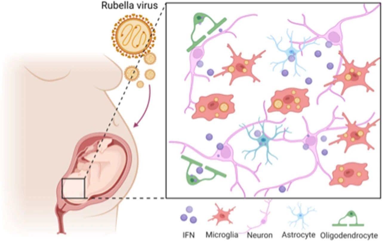 风疹病毒检测：选对原料，开启精准诊断之门，护航胎儿未来