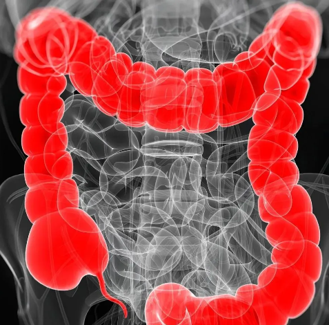重塑免疫微环境！复旦大学发文：新的结直肠癌免疫治疗策略