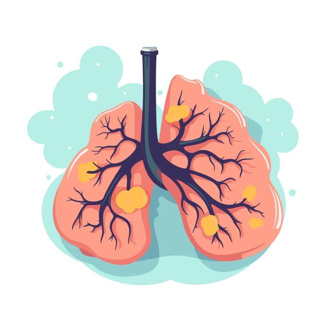 双管齐下！上海交大发现同时延缓肺癌复发+缓解耐药的创新疗法