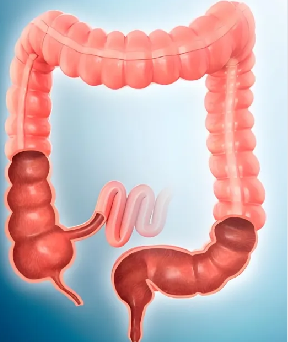 破解化疗耐药困局！中山大学发现奥沙利铂疗效预测新指标，结直肠癌治疗更精准