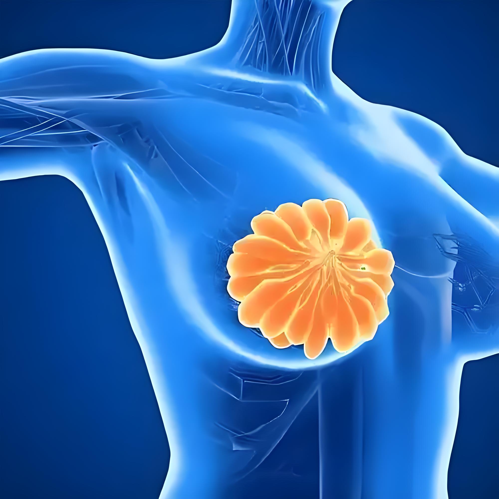 “最毒乳腺癌”治疗迎突破：安徽医科大学团队揭示糖酵解关键靶点