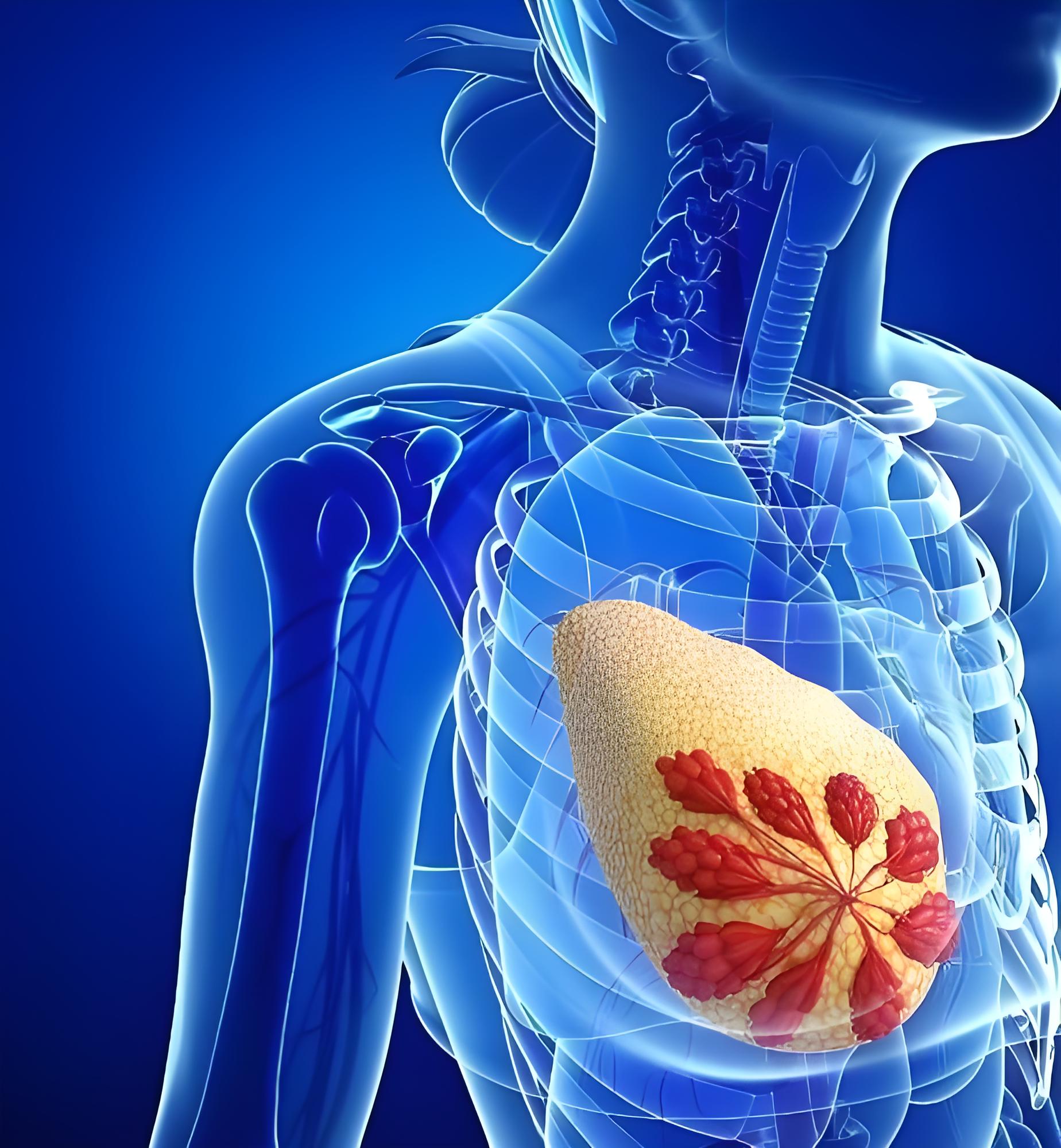 联合疗法攻坚“粉红杀手”：广州医科大学/贵州医科大学两校合作揭示乳腺癌治疗新靶点