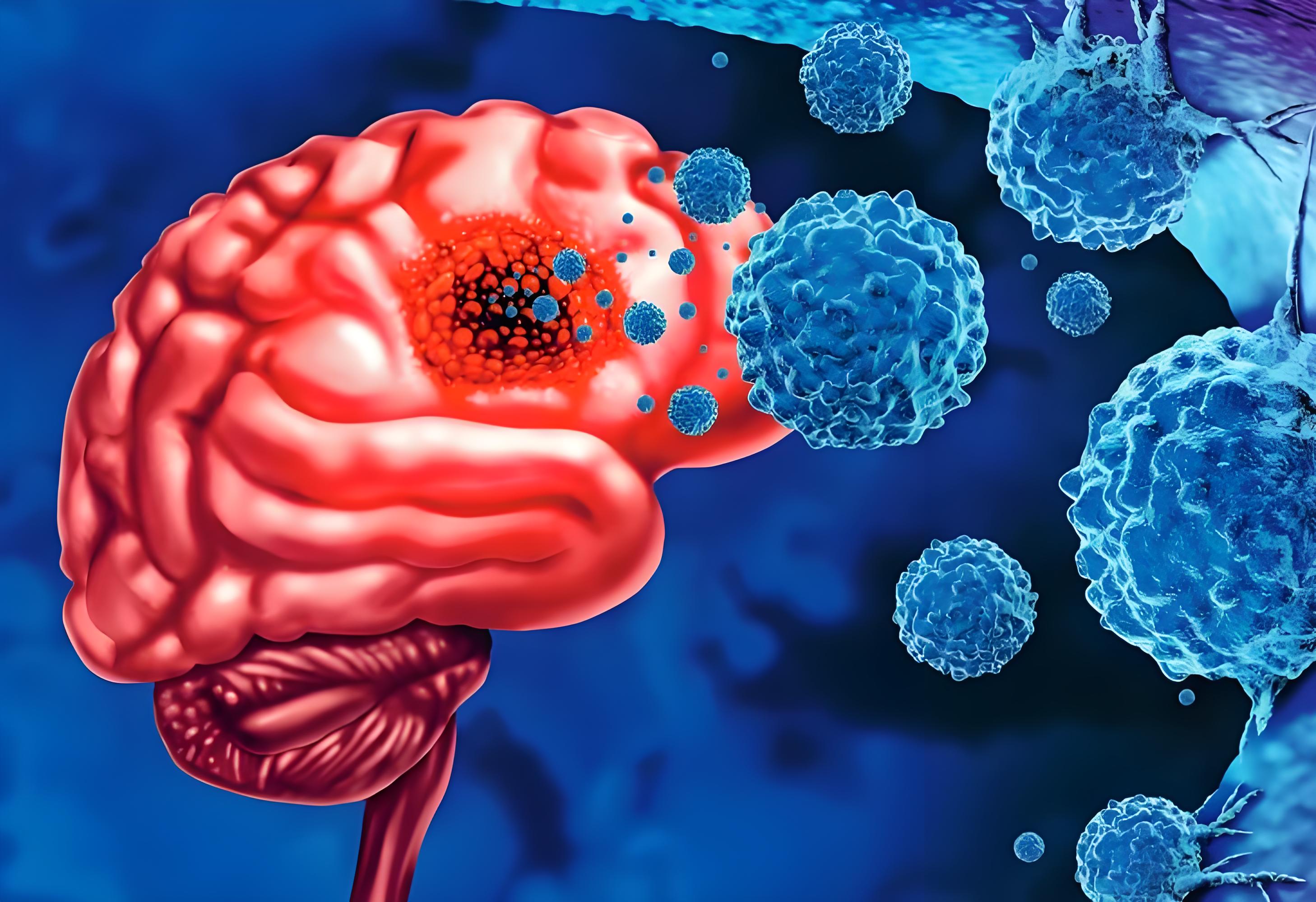 铁死亡调控新发现! 南方医科大学发文：胶质瘤治疗潜在靶点