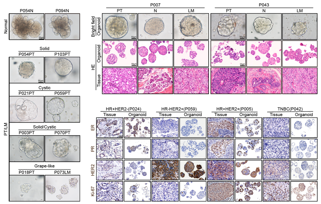 Cell Stem Cell | 复旦大学附属肿瘤医院郭小毛/俞晓立/陈飞/沈敏洪团队合作构建乳腺癌类器官多组学图谱，解析四种表观状态，揭示驱动乳腺癌淋巴结转移的关键转录因子