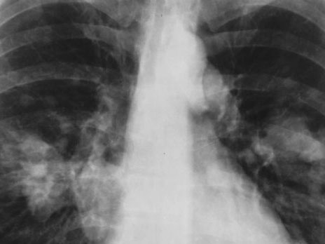 Science：科学家提出肿瘤异质性新概念