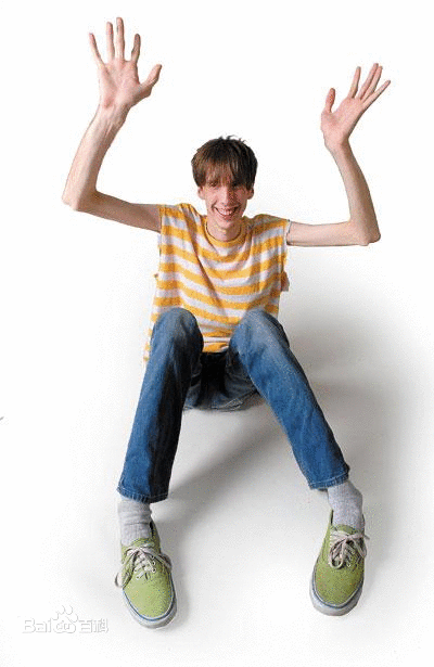 NIH：研究表明，氯沙坦可能会是马凡综合征的良好治疗选择