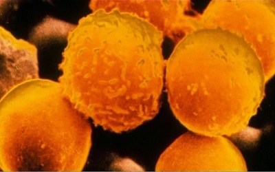 BBC：治疗白血病临床试验药物问世！